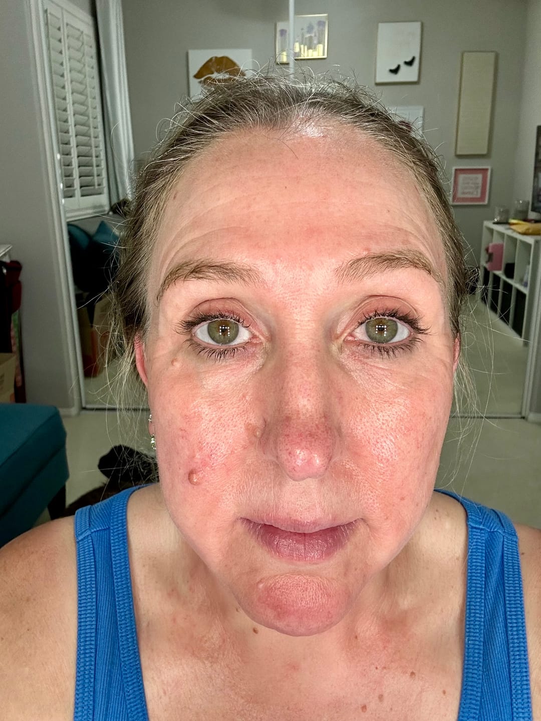 Customer photo review of CE SERUM | COMPLEXION BRIGHTENING