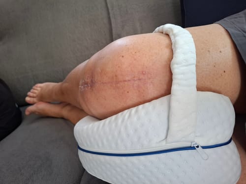 Client utilisant le coussin orthopédique Cellsius entre ses jambes, avec une cicatrice chirurgicale visible sur le genou.