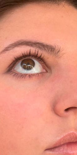 Customer photo review of BOOSTER Serum