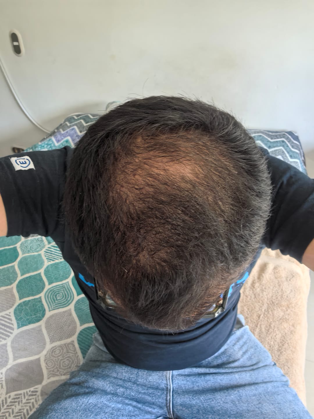 Customer photo review of Tónico Capilar de Romero, Ortiga, Clavo y Canela