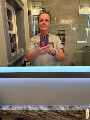 Customer's selfie showing her face after using the Seranova Micro Infusion System.