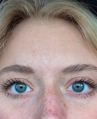 Customer photo review of BOOSTER Serum