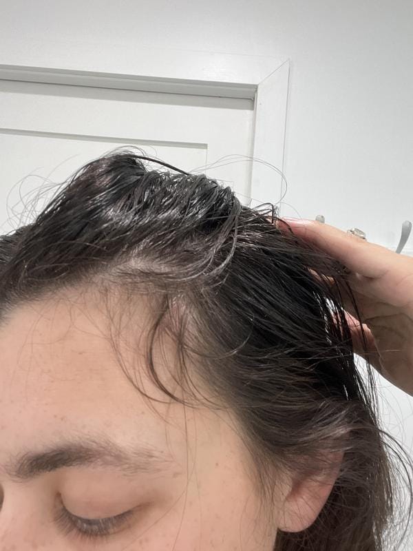 Customer photo review of KosmaHair Sérum | Restaurador Capilar & Entradas