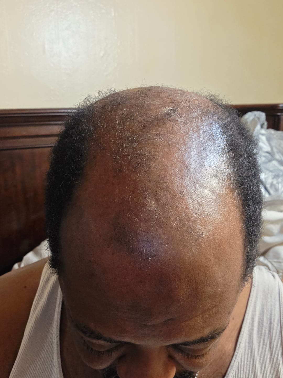 Customer photo review of Rennora Hair Growth Serum