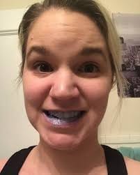 Customer photo review of GlorySmile™ V34 Whitening Toothpaste (30 ml)