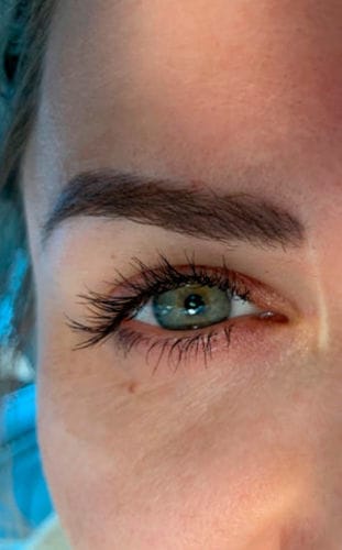 Customer photo review of BOOSTER Serum