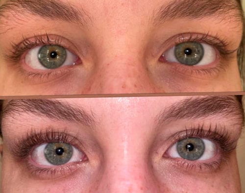 Customer photo review of BOOSTER Serum