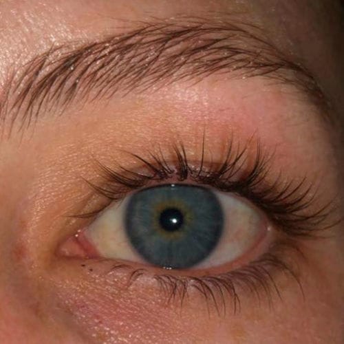 Customer photo review of BOOSTER Serum