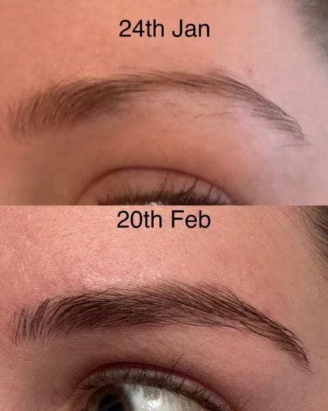 Customer photo review of Eyebrow Growth Serum