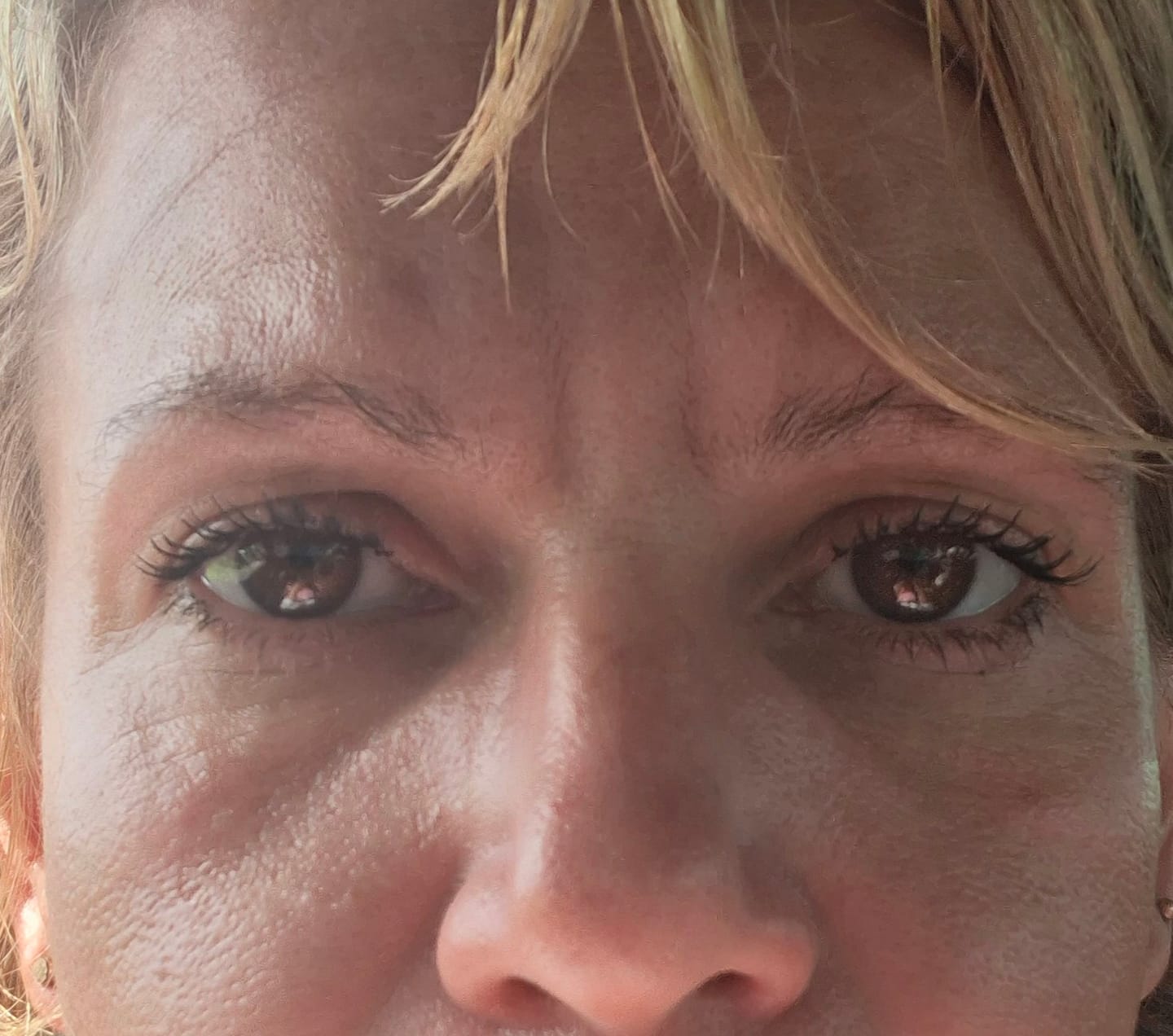 Customer photo review of BRIGHT & TIGHT UNDER EYE CREAM
