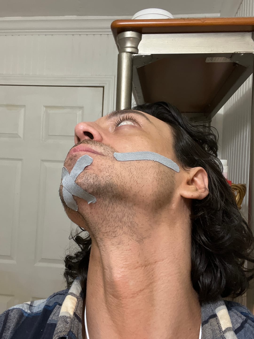 Customer photo review of Zygo Tape - Facial Sculpting & Anti-Aging Tape