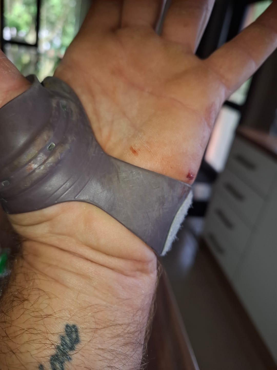 Customer photo review of Push Ortho CMC Thumb Brace – Osteoarthritis Support Splint for Thumb Joint Stabilisation