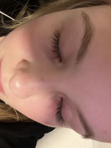 Customer photo review of BOOSTER Serum