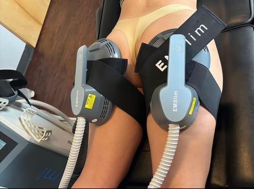 Customer photo review of EMS Nova Body Sculpting Machine