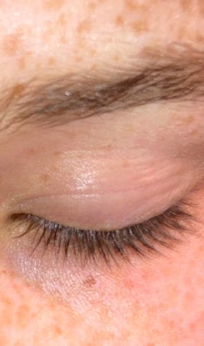 Customer photo review of BOOSTER Serum