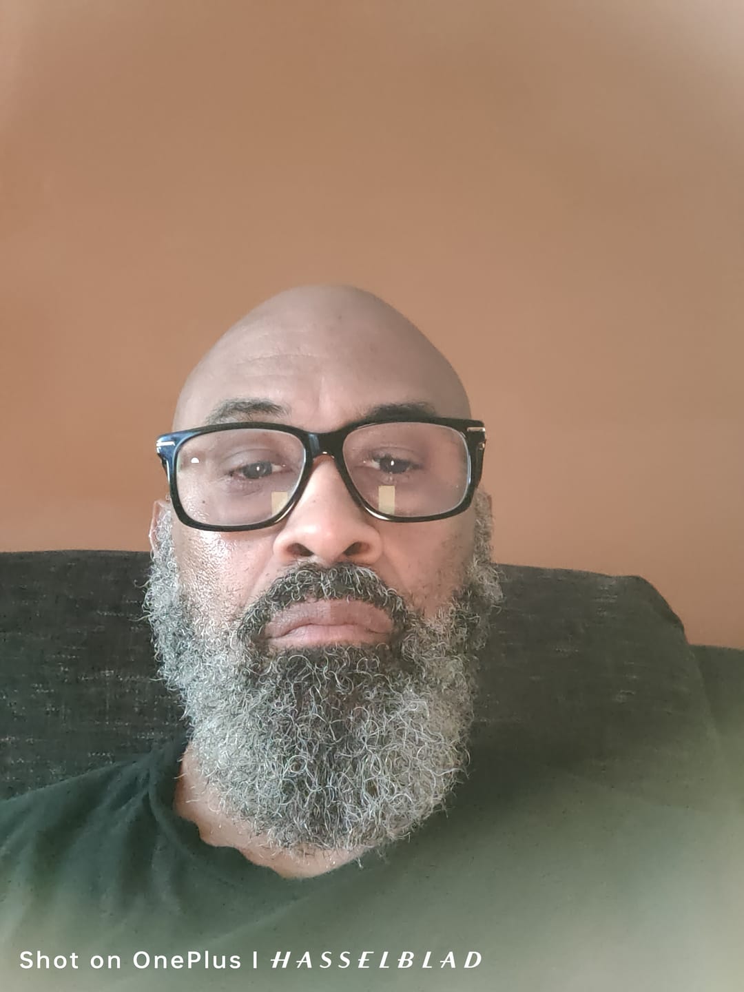 Customer photo review of Beard Hydration Kit