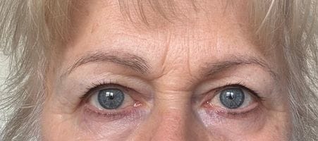 Customer photo review of Eyebrow Growth Serum
