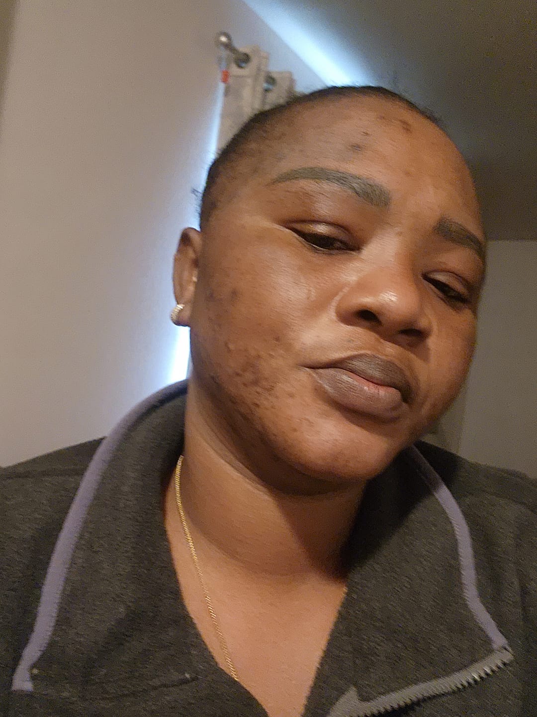 Customer photo review of Turmeric Fade & Glow Bar.