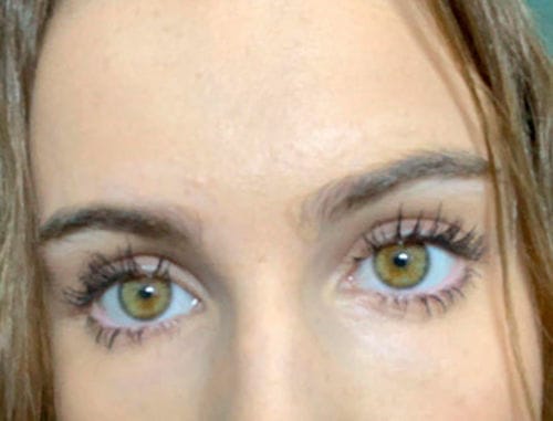 Customer photo review of BOOSTER Serum