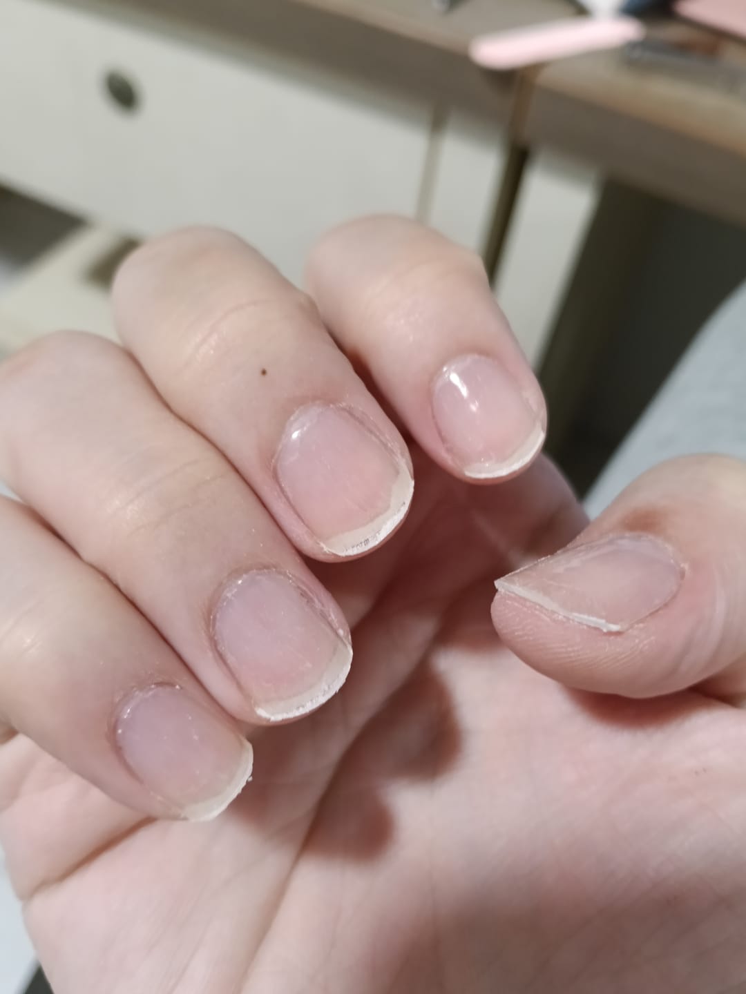 Customer photo review of Crystal Clear DIY Semicured Gel Nail Sticker Kit (STOP NAIL BITING & GROW BRITTLE NAILS)