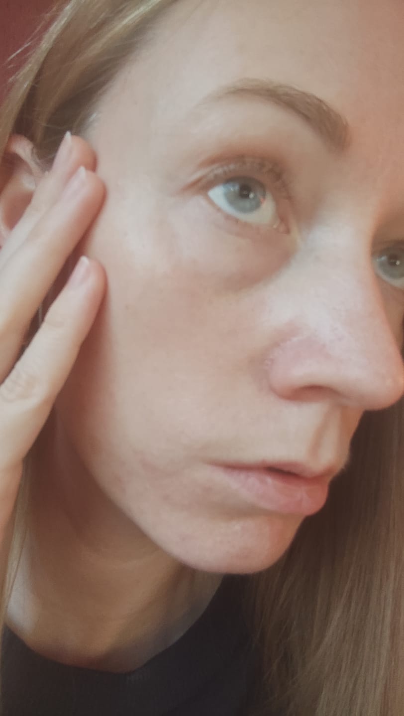 Customer photo review of Serums jutīgai ādai bez eļļām Purito Wonder Releaf Centella Serum Unscented