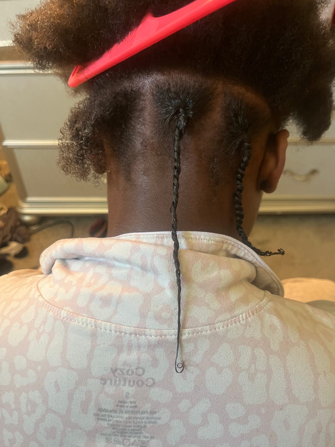 Customer photo review of Scalp Stimulator- 3 Month Supply