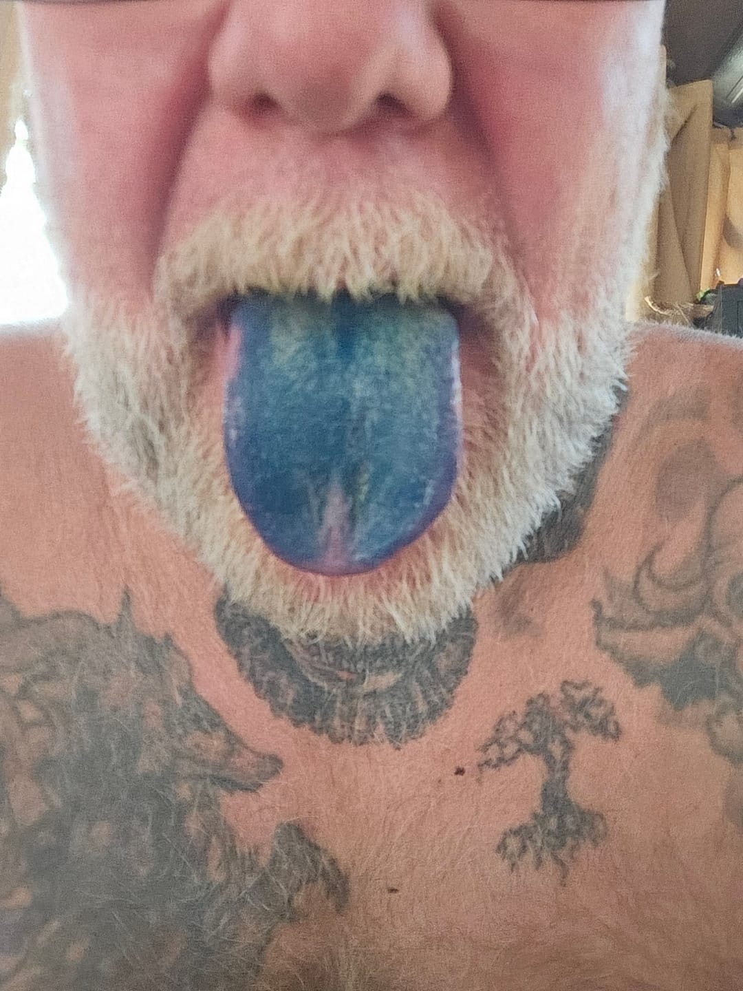 Customer photo review of Ultra Methylene Blue - Fresh Mint Flavor (50mL) (30 Servings)