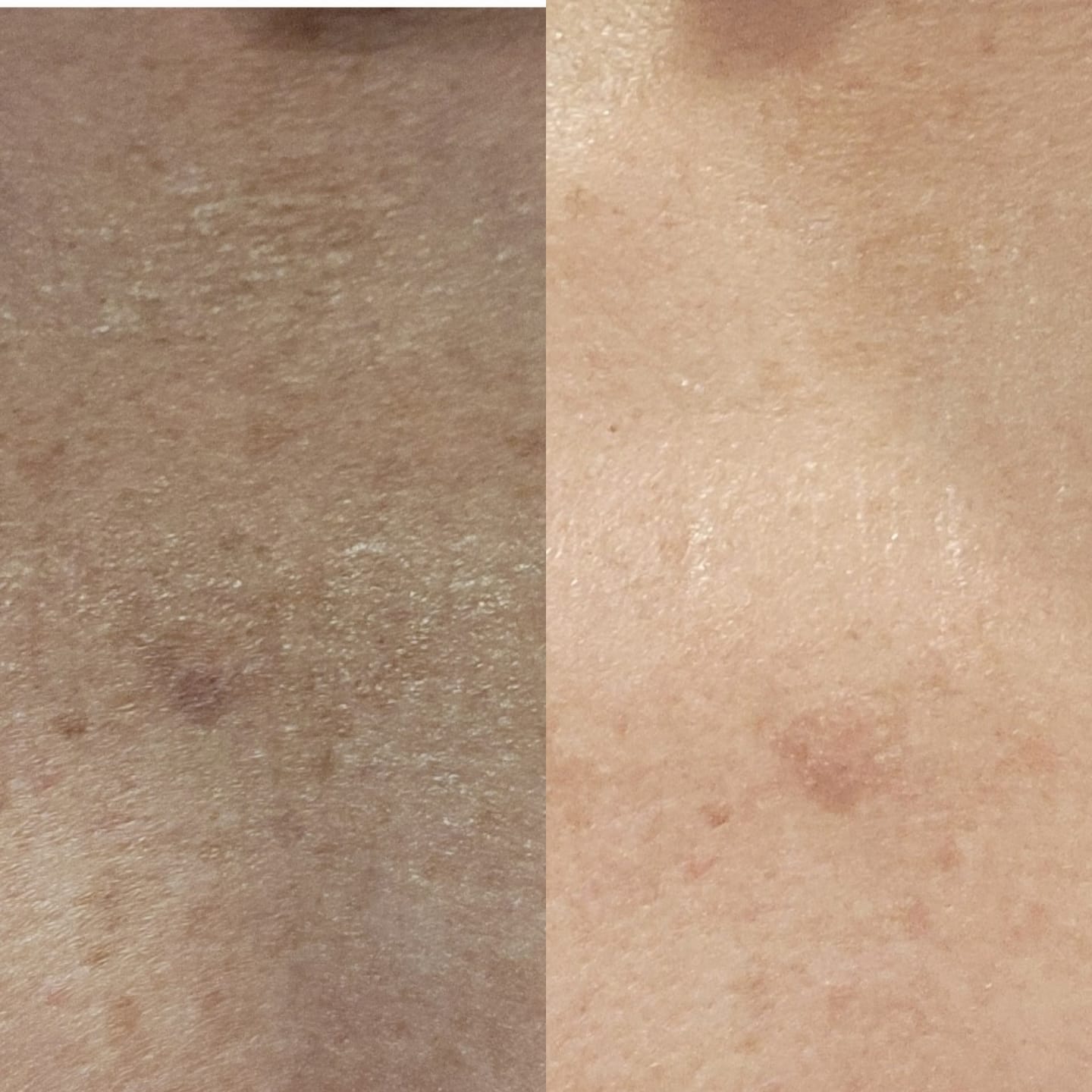 Customer photo review of Besque® Magic Body Oil - Unscented