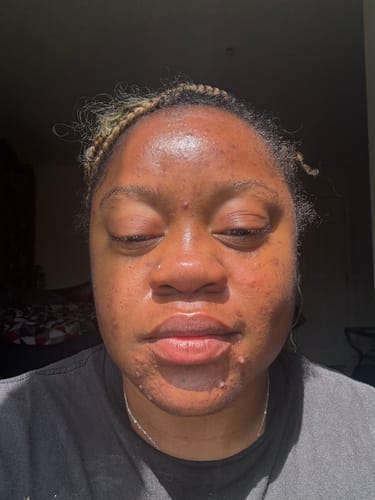 Customer photo review of Face Serum (ALL DAY WEAR)
