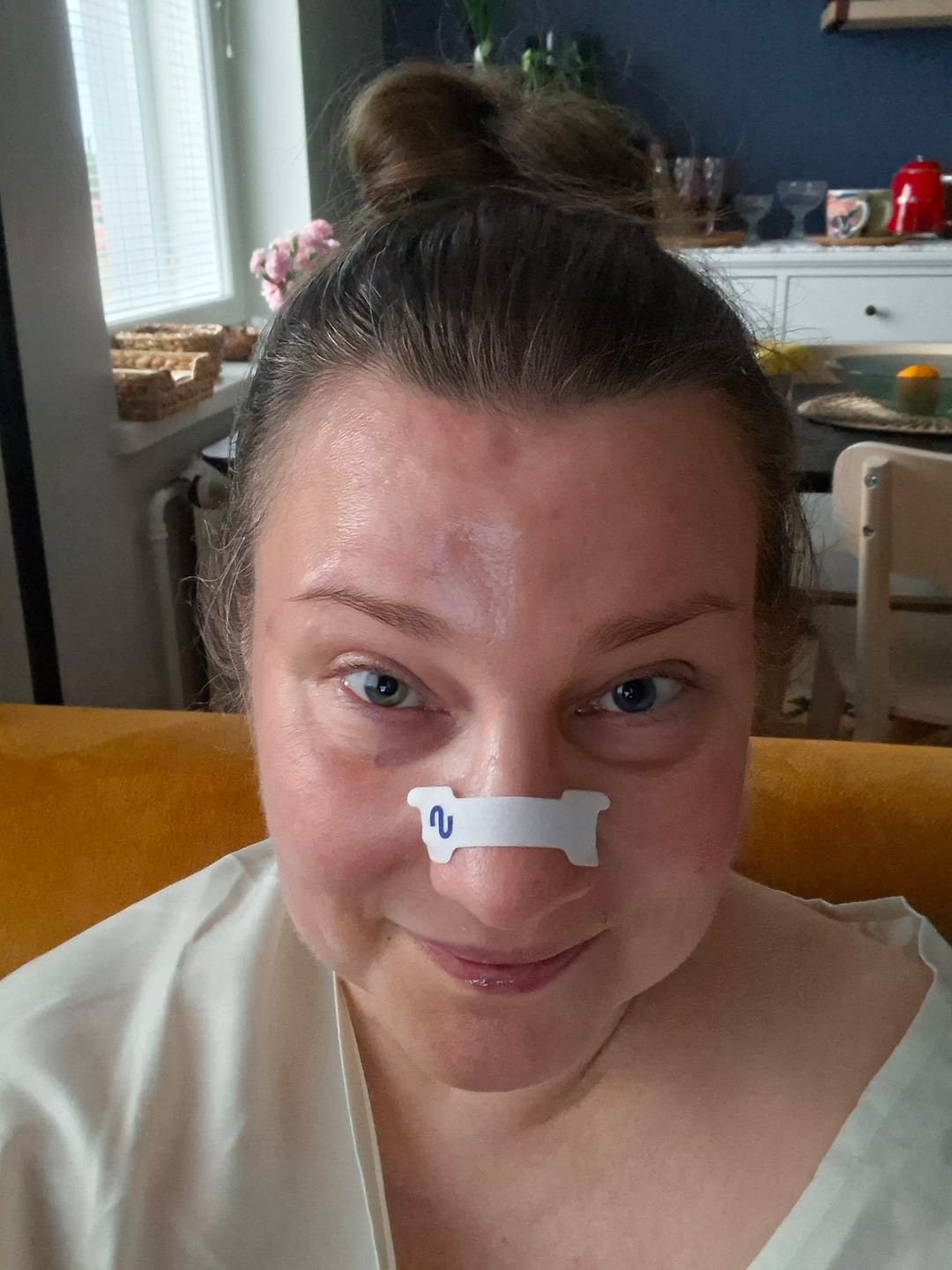 Customer photo review of Nuku Sleep Nasal Strips