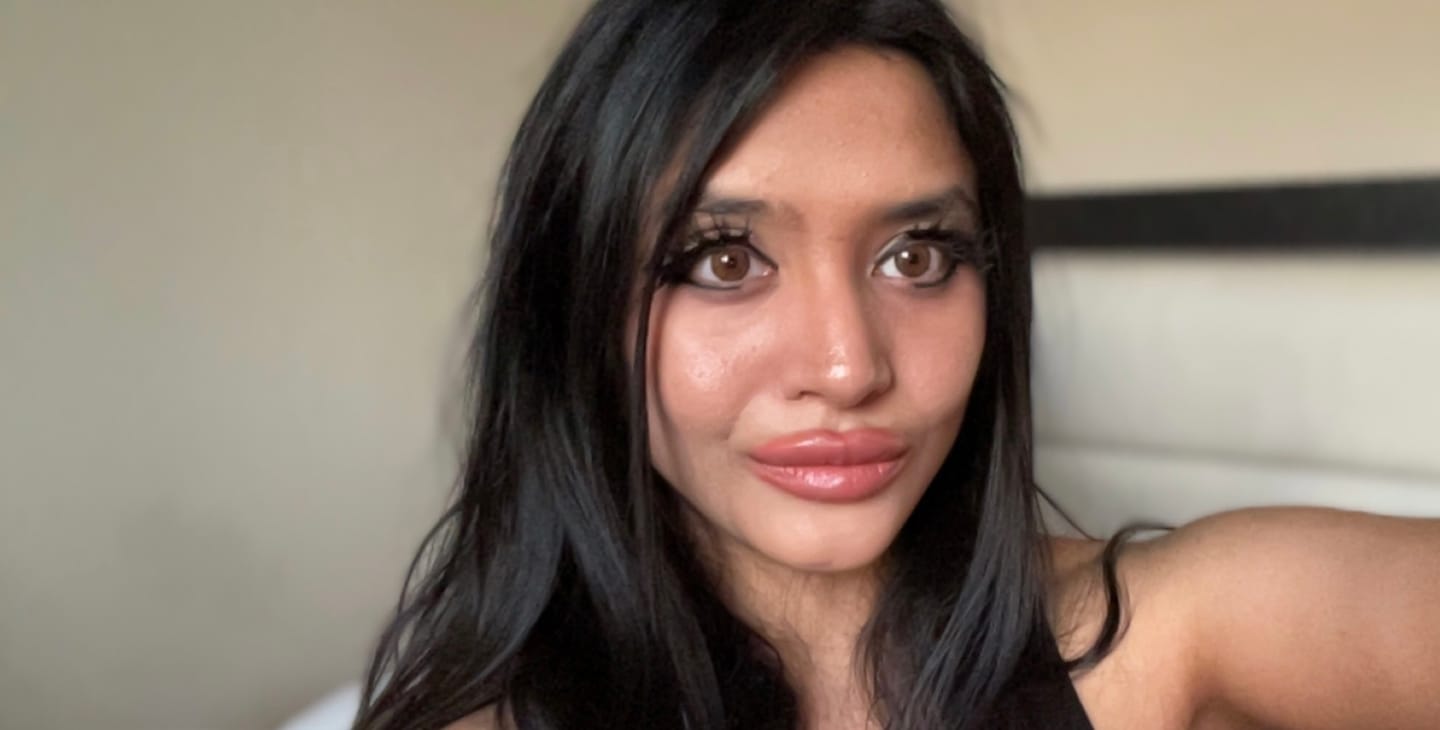 Customer photo review of Three Tone HONEY Brown Prescription Coloured Contact Lenses
