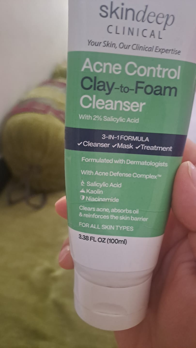 Customer photo review of Acne Control Clay-to-Foam Cleanser