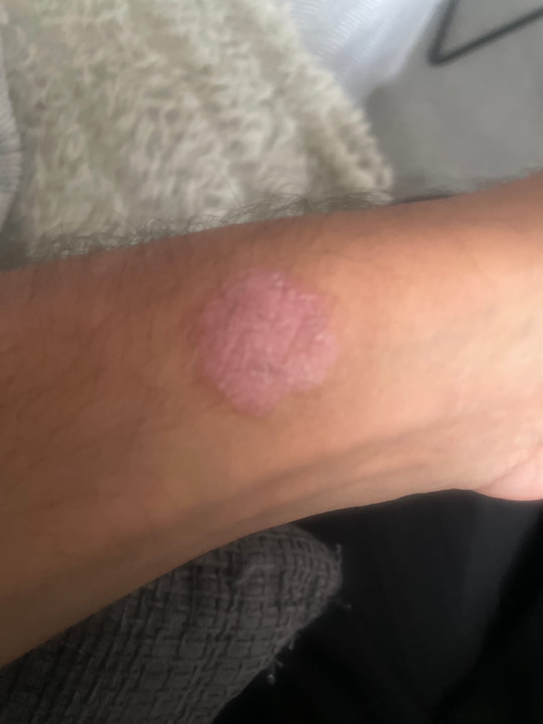 Customer photo review of Seb Natural Soothing Balm