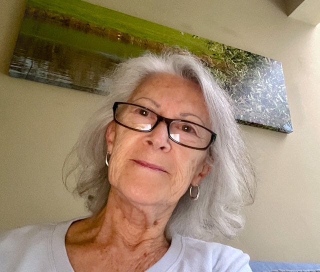 Customer photo review of Hair Growth Hero Bundle