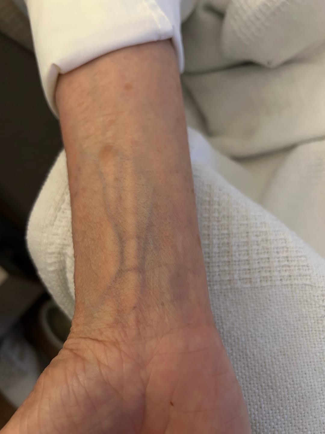 Customer photo review of Crescel Skin Renewal Cream - 3.4 oz