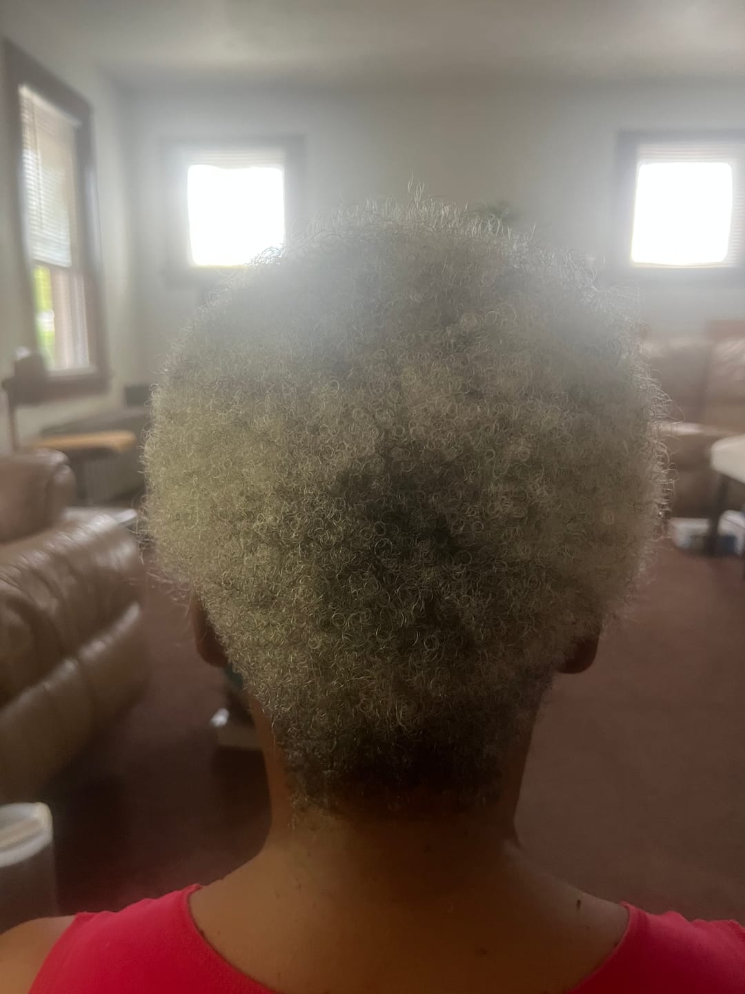 Customer photo review of Rennora Hair Growth Serum