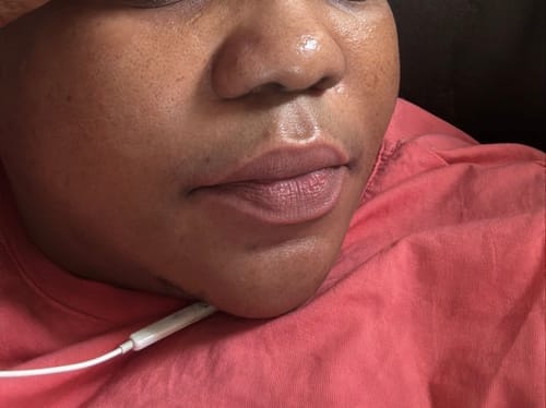 Customer photo review of BAUME À LÈVRE ROSE PERMANENT, EXFOLIE, ROSIE ET HYDRATE
