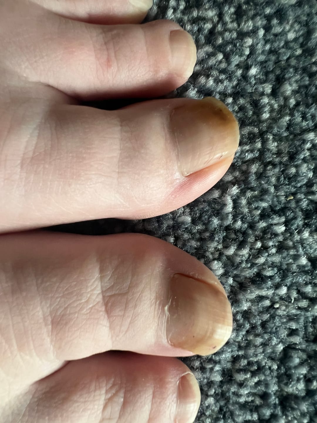 Customer photo review of Fungal Freedom