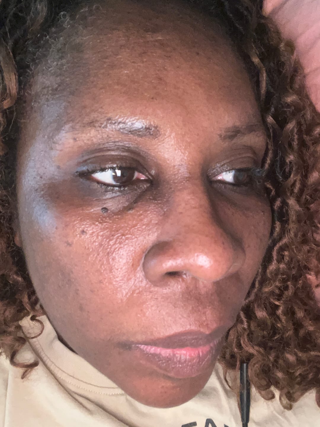 Customer photo review of Turmeric and Kojic Foaming Face Wash