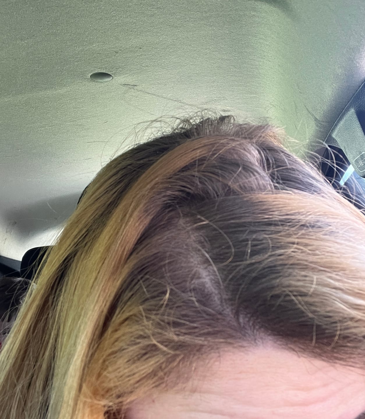 Customer photo review of Mega Pack Cheveux - Pousse et Anti-chute