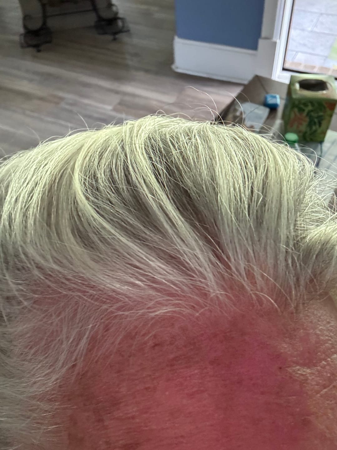Customer photo review of DHT BLOCKER