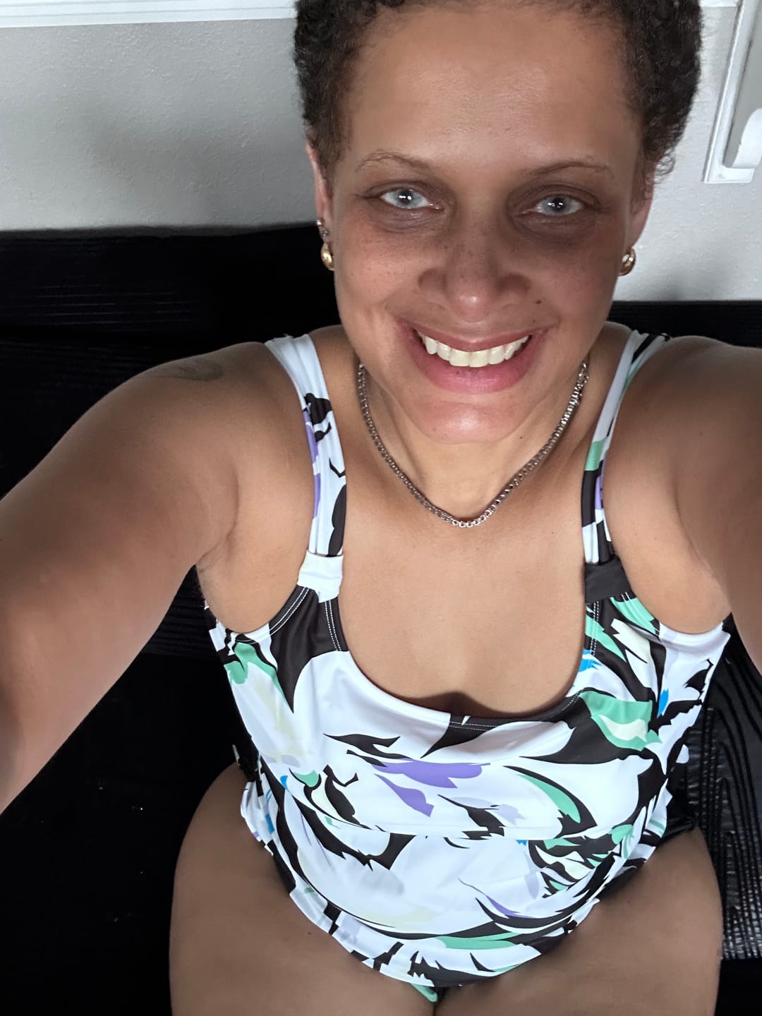 Customer photo review of Hidrocor Icy Gray Prescription Colored Contact Lenses