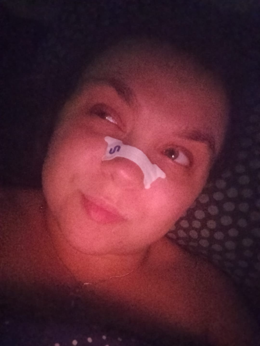 Customer photo review of Nuku Sleep Nasal Strips (Pre-order)