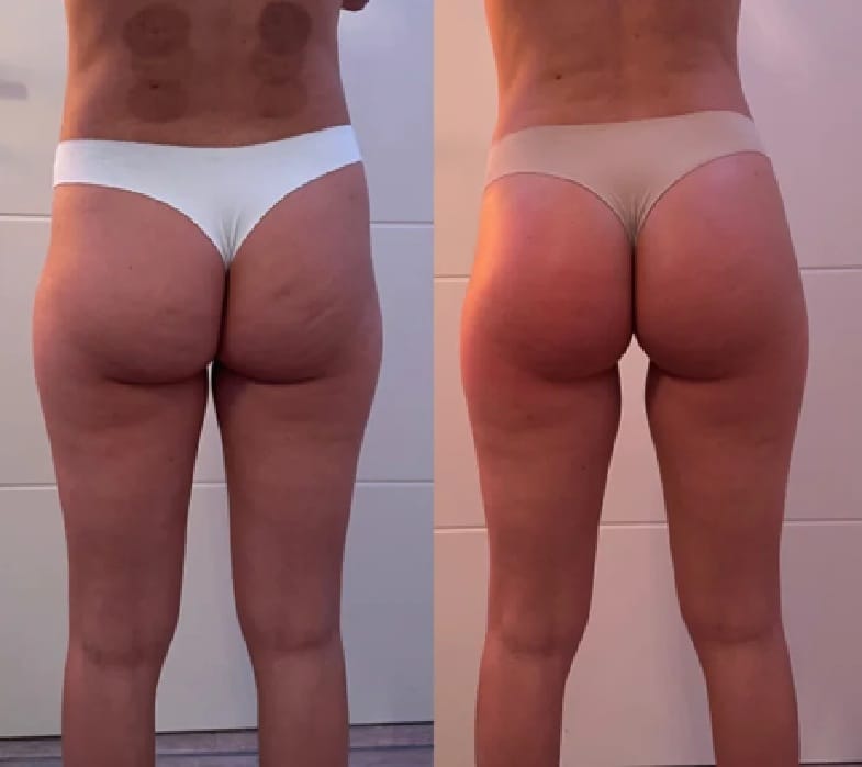Customer photo review of Nordlys™ 3D Shape Leggings