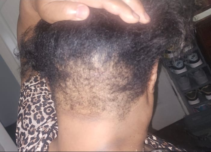 Customer photo review of Healthy Hair Starter Kit - Limited Edition