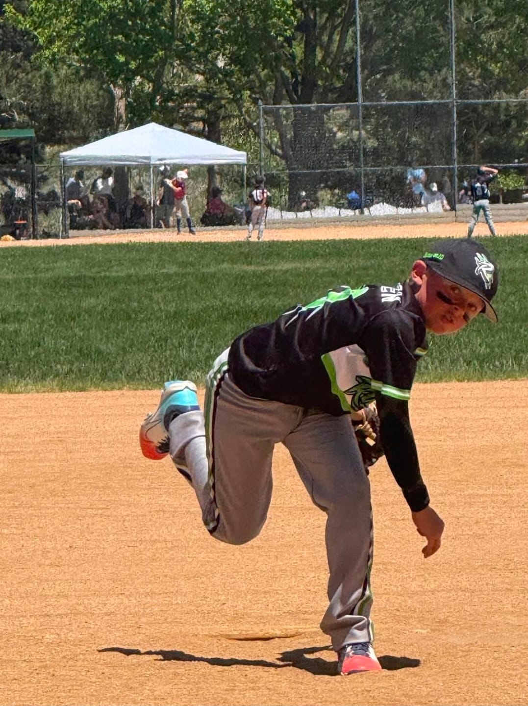 Customer photo review of Dynamic Shoulder & Elbow Stabilizer - K2 Youth Sleeve
