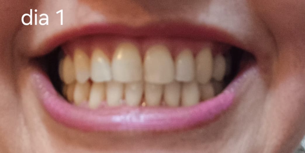 Customer photo review of Kit Smile+
