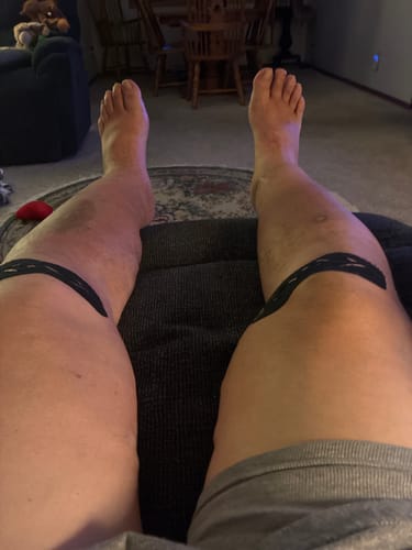 Customer photo review of Easy Kinesiology Tape (30-Day Supply)