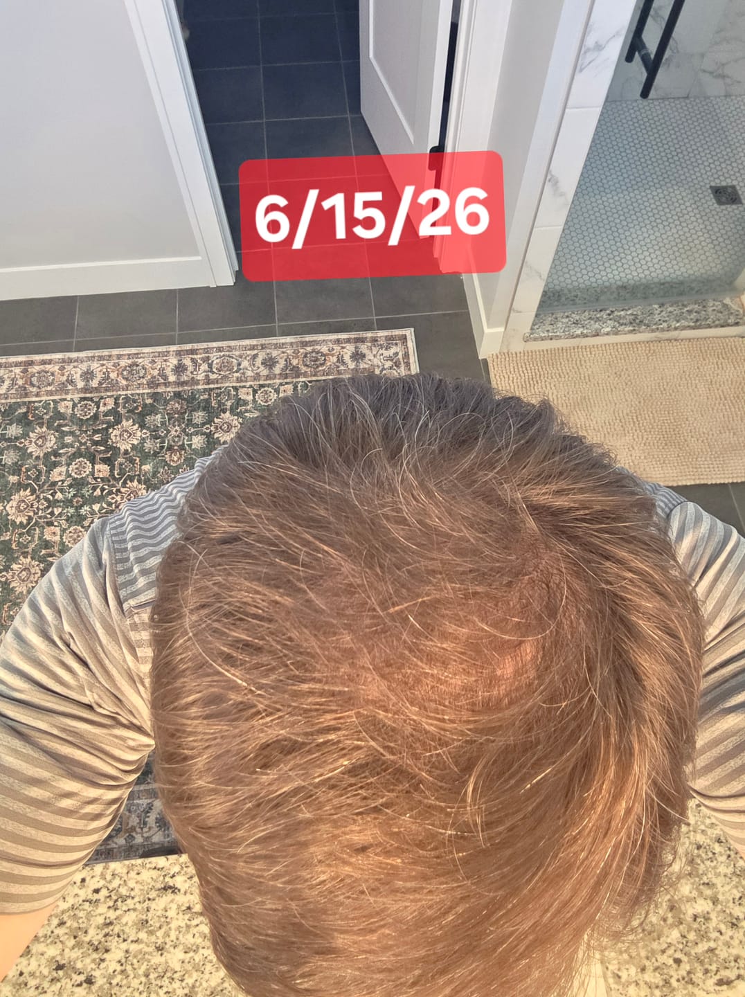 Customer photo review of SPARTAN™ - Red Light Growth Cap