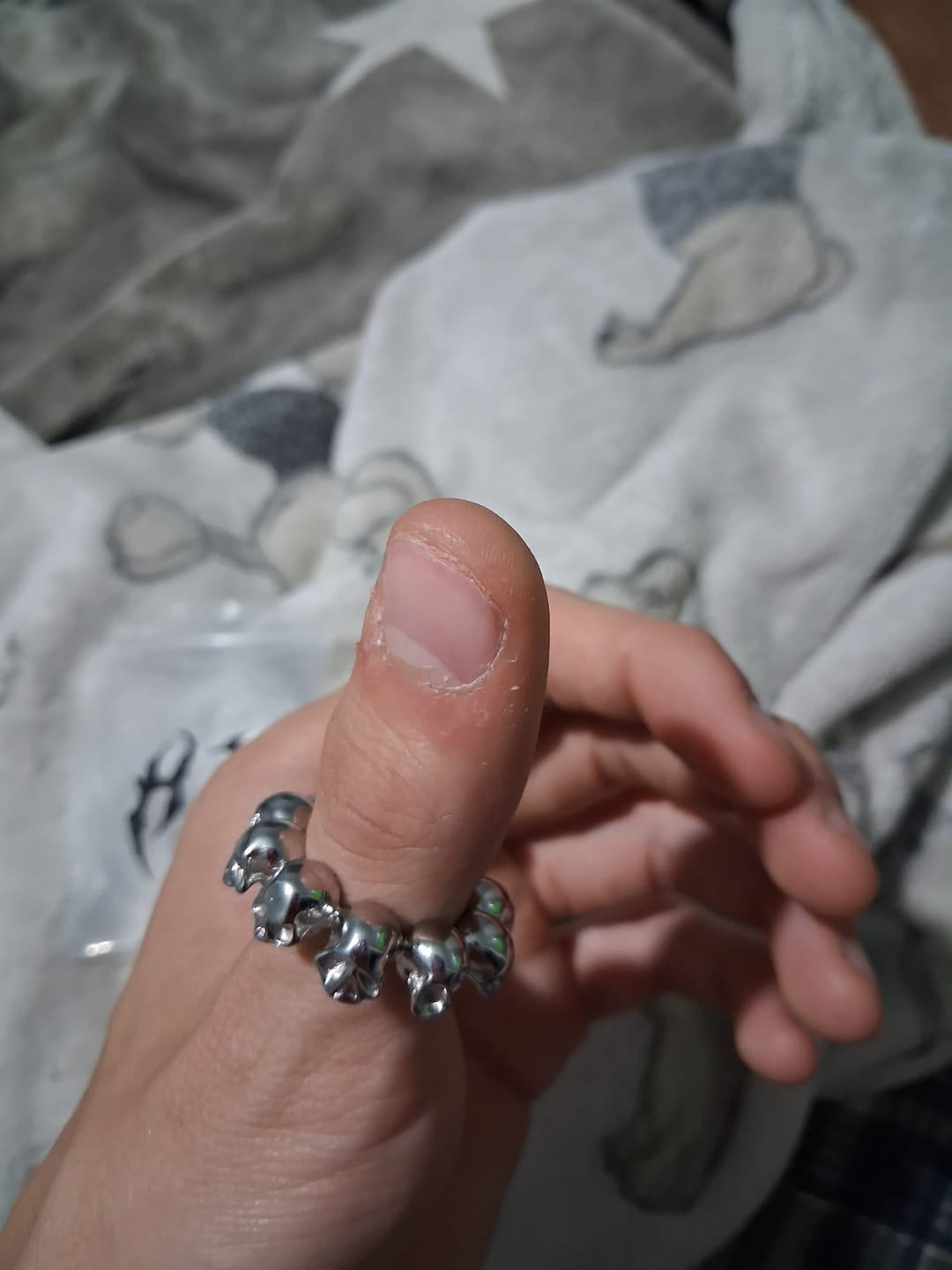 Customer photo review of 10 STAGES OF ADDICTION RING